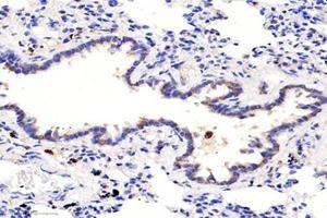 Immunohistochemistry analysis of paraffin-embedded rat lung using,PSMD8 (ABIN7075226) at dilution of 1: 2600