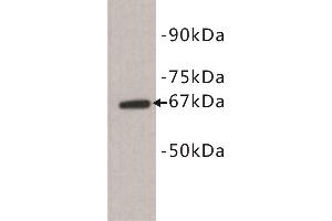 Western Blotting (WB) image for anti-Selectin E (SELE) (N-Term) antibody (ABIN1854888) (Selectin E/CD62e anticorps  (N-Term))