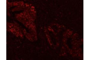 IF analysis of FEN1 using anti-FEN1 antibody (ABIN7601617). (FEN1 anticorps  (AA 4-300))