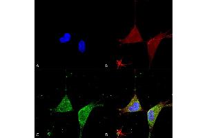 Immunocytochemistry/Immunofluorescence analysis using Mouse Anti-GABA A Receptor Alpha 5 Monoclonal Antibody, Clone S415-24 (ABIN2485763).