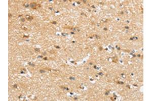 The image on the left is immunohistochemistry of paraffin-embedded Human brain tissue using ABIN7192978(UBTD2 Antibody) at dilution 1/35, on the right is treated with synthetic peptide. (UBTD2 anticorps)