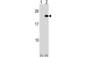 Western Blotting (WB) image for anti-ADP-Ribosylation Factor 5 (ARF5) antibody (ABIN2999205) (ARF5 anticorps)