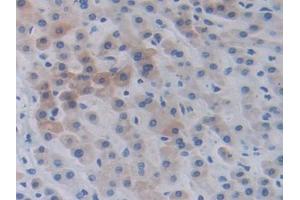 DAB staining on IHC-P; Samples: Human Liver Tissue