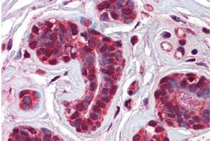 anti-Checkpoint with Forkhead and Ring Finger Domains (CHFR) (AA 36-85) antibody