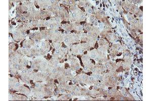Immunohistochemical staining of paraffin-embedded Human liver tissue using anti-GIMAP4 mouse monoclonal antibody. (GIMAP4 anticorps)
