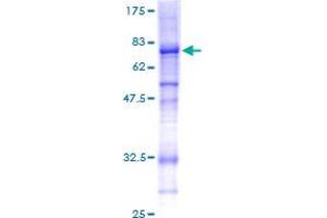 Image no. 1 for Collagen, Type VI, alpha 2 (COL6A2) (AA 1-425) protein (GST tag) (ABIN1349984)
