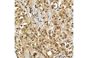 Immunohistochemistry of paraffin-embedded human colon using S6 Ribosomal Protein (RPS6) Rabbit pAb (ABIN6133901, ABIN6147227, ABIN6147228 and ABIN6221687) at dilution of 1:100 (40x lens).
