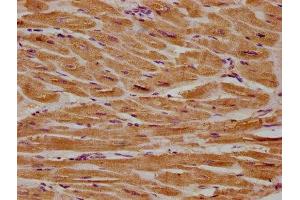 IHC image of ABIN7154398 diluted at 1:300 and staining in paraffin-embedded human heart tissue performed on a Leica BondTM system.