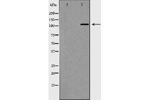 Western blot analysis of extracts of K-562 , using NLRP3 antibody. (NLRP3 anticorps)