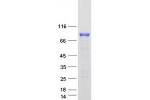 Validation with Western Blot