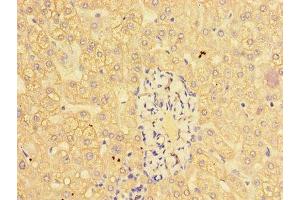Immunohistochemistry of paraffin-embedded human liver tissue using ABIN7147018 at dilution of 1:100 (Cathepsin L anticorps  (AA 114-288))