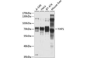 Western blot analysis of extracts of various cell lines, using Y antibody (ABIN6132788, ABIN6150316, ABIN6150321 and ABIN6215135) at 1:1000 dilution. (YAP1 anticorps  (AA 155-504))