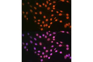 Immunofluorescence analysis of NIH-3T3 cells using TDP-43/TARDB Rabbit pAb (ABIN6128807, ABIN6148854, ABIN6148857 and ABIN6217391) at dilution of 1:100 (40x lens). (TARDBP anticorps  (AA 1-100))
