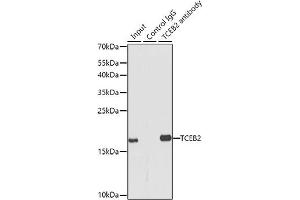 Immunoprecipitation analysis of 150 μg extracts of MCF7 cells using 3 μg TCEB2 antibody (ABIN6131621, ABIN6148934, ABIN6148936 and ABIN6217328).
