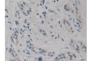 anti-Interleukin-27 subunit beta (IL-27b) (AA 21-229) antibody