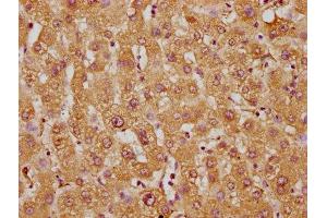 Immunohistochemistry of paraffin-embedded human liver tissue using ABIN7171480 at dilution of 1:100 (WRB anticorps  (AA 38-99))