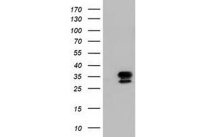 Western Blotting (WB) image for anti-E3 SUMO-Protein Ligase NSE2 (NSMCE2) antibody (ABIN1499527) (NSMCE2 anticorps)