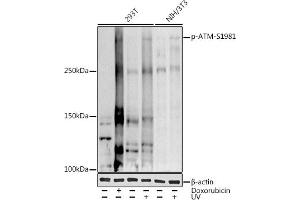 Western blot analysis of extracts of various cell lines, using (ABIN3019428, ABIN3019429, ABIN3019430 and ABIN6225361) at 1:1000 dilution. (ATM anticorps  (pSer1981))