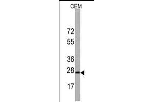Western blot analysis of BarX1 Antibody in CEM cell line lysates (35ug/lane). (BARX1 anticorps  (C-Term))