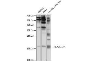 Western blot analysis of extracts of various cell lines, using PLG12A antibody (ABIN7269339) at 1:1000 dilution. (PLA2G12A anticorps  (AA 1-100))
