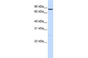 WB Suggested Anti-NOTCH1 Antibody Titration:  0. (Notch1 anticorps  (Middle Region))