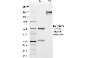 SDS-PAGE Analysis Purified N-Cadherin Mouse Monoclonal Antibody (CDH2/1573). (N-Cadherin anticorps  (Intracellular))
