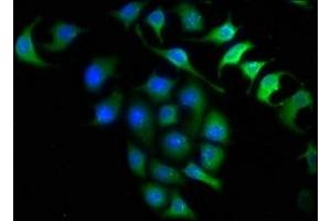Immunofluorescence staining of A549 cells with ABIN7156215 at 1:150, counter-stained with DAPI.