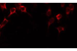 ABIN6268681 staining COLO205 by IF/ICC.