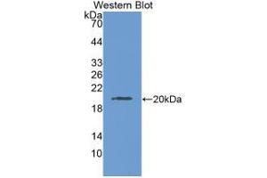 Western Blot ; Sample: Recombinant LAMC3, Human. (LAMC3 anticorps  (AA 1250-1418))
