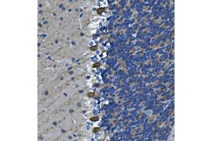 IHC analysis of DGKZ/DGK-zeta using anti-DGKZ/DGK-zeta antibody (ABIN7602261). (DGKZ anticorps  (AA 664-928))