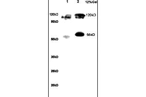 Formalin-fixed and paraffin embedded human gastric tissue labeled with Anti NRSF/REST Polyclonal Antibody,Unconjugated (ABIN747683) at 1:200 followed by conjugation to the secondary antibody and DAB staining.