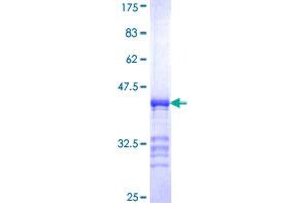 PJA2 Protein (AA 302-400) (GST tag)