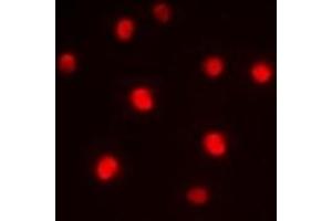 Immunofluorescent analysis of ZNF265 staining in HepG2 cells. (ZNF265 anticorps)