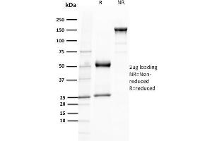 SDS-PAGE Analysis Purified TCL1 Mouse Monoclonal Antibody (TCL1/2079).