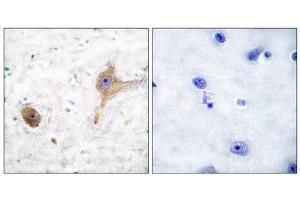 Immunohistochemistry (IHC) image for anti-GABA B Receptor (C-Term) antibody (ABIN1848554) (GABA B Receptor (C-Term) anticorps)