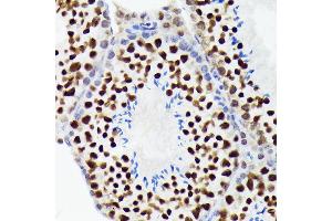 Immunohistochemistry of paraffin-embedded mouse testis using EWSR1 Rabbit mAb (ABIN7267053) at dilution of 1:100 (40x lens). (EWSR1 anticorps)