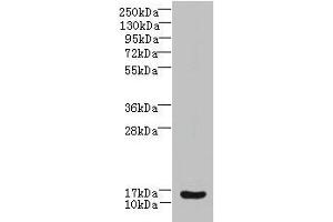 Western blot All lanes: ZNRD1 antibody at 14 μg/mL + Human high value serum Secondary Goat polyclonal to rabbit IgG at 1/10000 dilution Predicted band size: 14 kDa Observed band size: 14 kDa (ZNRD1 anticorps  (AA 1-126))