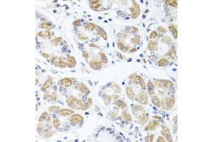 Immunohistochemistry of paraffin-embedded human stomach using ACP1 antibody (ABIN5975334) at dilution of 1/100 (40x lens). (ACP1 anticorps)