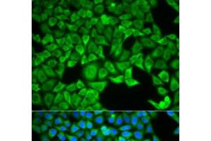 Immunofluorescence analysis of HeLa cells using SLC3A1 Polyclonal Antibody (SLC3A1 anticorps)