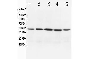 Anti-MTCO1 antibody, Western blotting Lane 1: MCF-7 Cell Lysate Lane 2: HELA Cell Lysate Lane 3: JURKAT Cell Lysate Lane 4: SMMC Cell Lysate Lane 5: COLO320 Cell Lysate