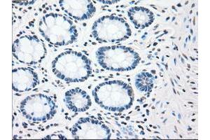Image no. 3 for anti-Checkpoint Kinase 2 (CHEK2) antibody (ABIN1497499) (CHEK2 anticorps)