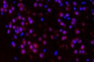 Immunofluorescent analysis of paraformaldehyde-fixed mouse brain substantia nigra using p38IP (ABIN7075954) at dilution of 1: 400 (Transcription Factor SPT20 Homolog (SUPT20H) anticorps)