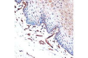 Immunohistochemistry of paraffin-embedded human esophageal using Cadherin-13 (CDH13) Rabbit mAb (ABIN7265996) at dilution of 1:100 (40x lens).