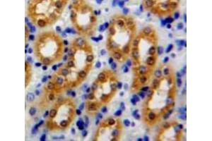 Used in DAB staining on fromalin fixed paraffin-embedded Kidney tissue (Peroxiredoxin 5 anticorps  (AA 1-162))