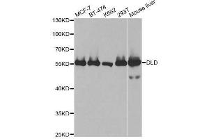 Western blot analysis of extracts of various cell lines, using DLD antibody. (DLD anticorps  (AA 36-300))