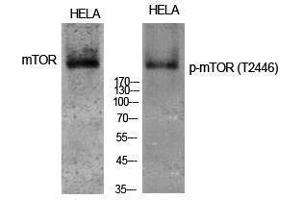 Western Blotting (WB) image for anti-Mechanistic Target of Rapamycin (serine/threonine Kinase) (mTOR) (pThr2446) antibody (ABIN3179552) (MTOR anticorps  (pThr2446))