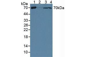 Figure. (CRAT anticorps  (AA 1-430))