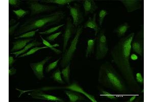 Immunofluorescence of purified MaxPab antibody to RBMY1A1 on HeLa cell.