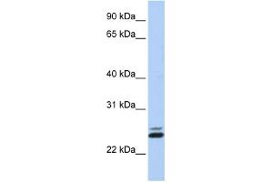 WB Suggested Anti-JAZF1 Antibody Titration:  0. (JAZF1 anticorps  (N-Term))