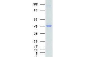 Validation with Western Blot